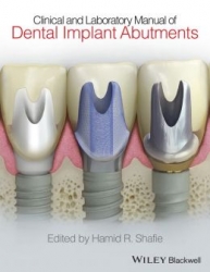 Clinical and Laboratory Manual of Dental Implant Abutments (pdf)